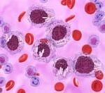 Cancer Diagnostics Landscape Expands as NICE Recommends Acalabrutinib-Based Treatments for Blood Cancers