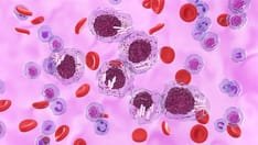 Cancer Diagnostics Landscape Expands as NICE Recommends Acalabrutinib-Based Treatments for Blood Cancers