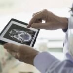 Canada Launches Major AI in Healthcare Trial Across 13 Ontario Hospitals to Prevent Delirium