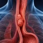 Cancer Therapeutics Market Gains New Viral Therapy Option as Telomelysin Launches in Japan for Esophageal Cancer