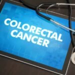 Cancer Diagnostics Gets New Patient Education Push as Alliance and Abbott Launch CRC Screening Hub