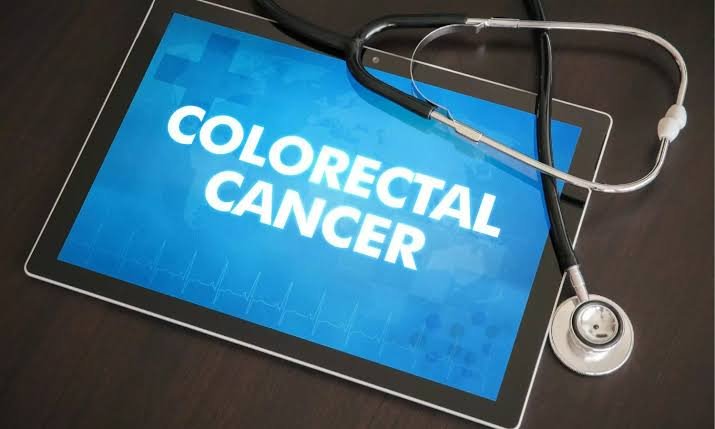 Cancer Diagnostics Gets New Patient Education Push as Alliance and Abbott Launch CRC Screening Hub