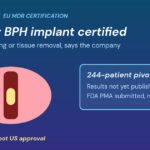 Graphic: Butterfly Medical prostate device EU approval, an enlarged prostate with an implant opening the urethra beside notes on a 244-patient trial and a pending FDA application