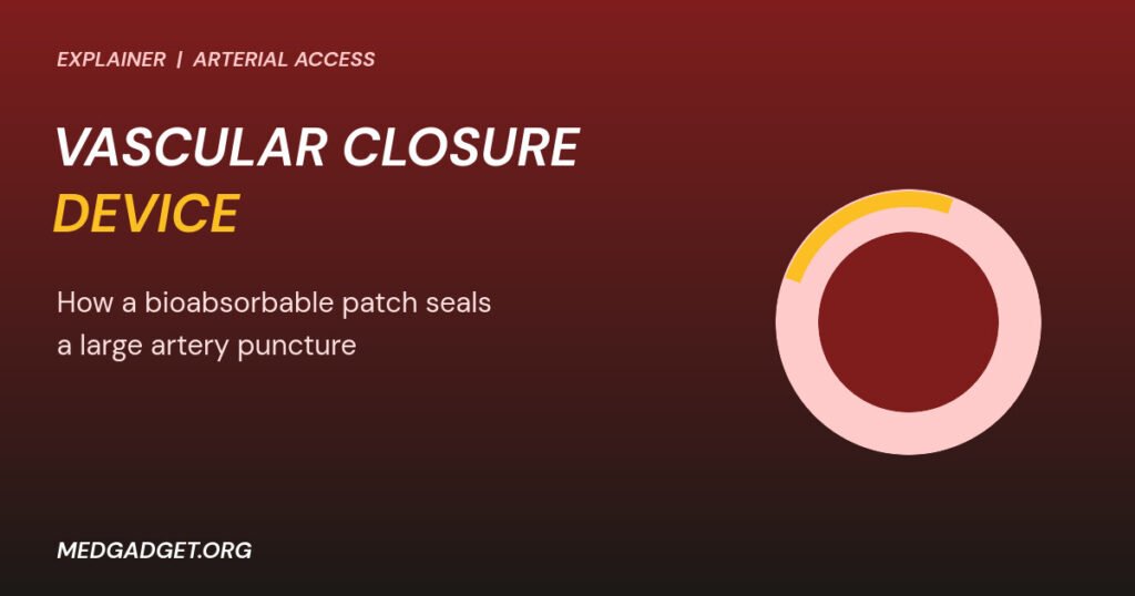 Graphic: vascular closure device patch sealing an artery cross-section