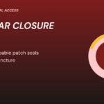 Graphic: vascular closure device patch sealing an artery cross-section